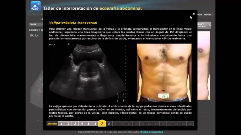 Interpretación óptima de ecografía abdominal: Descubriendo el diagnóstico